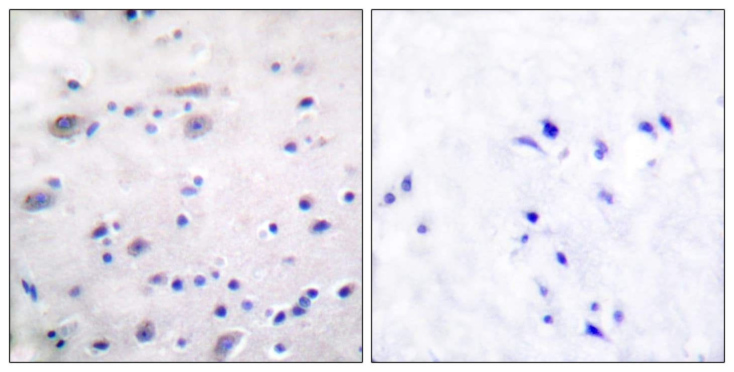 Polyclonal Rabbit anti-Human OPRM1 / Mu Opioid Receptor Antibody (phospho-Ser375, IHC)