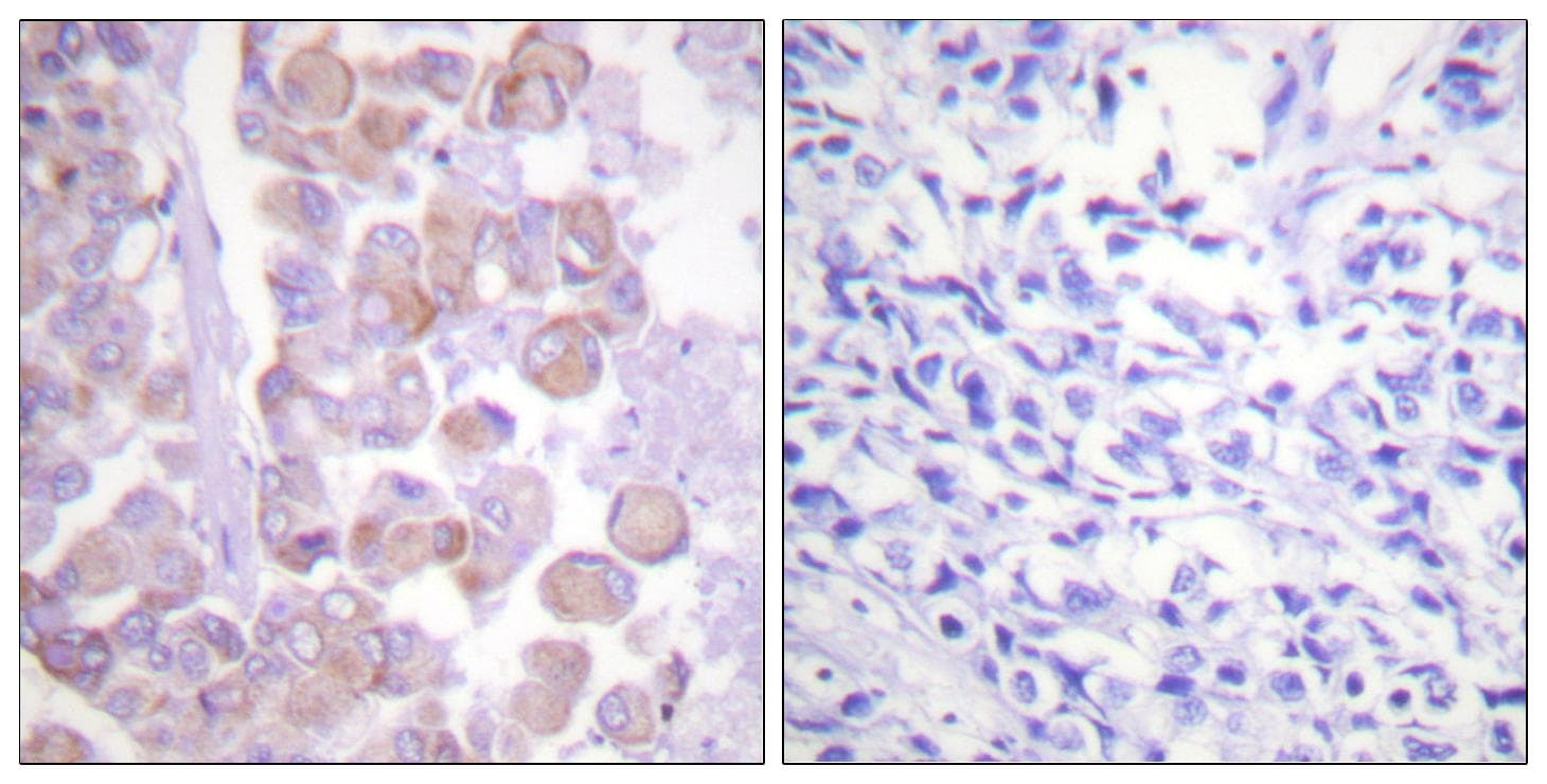 SNCA / Alpha-Synuclein Antibody (p129)