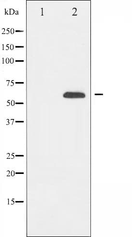 FOXO4 / AFX1 Antibody