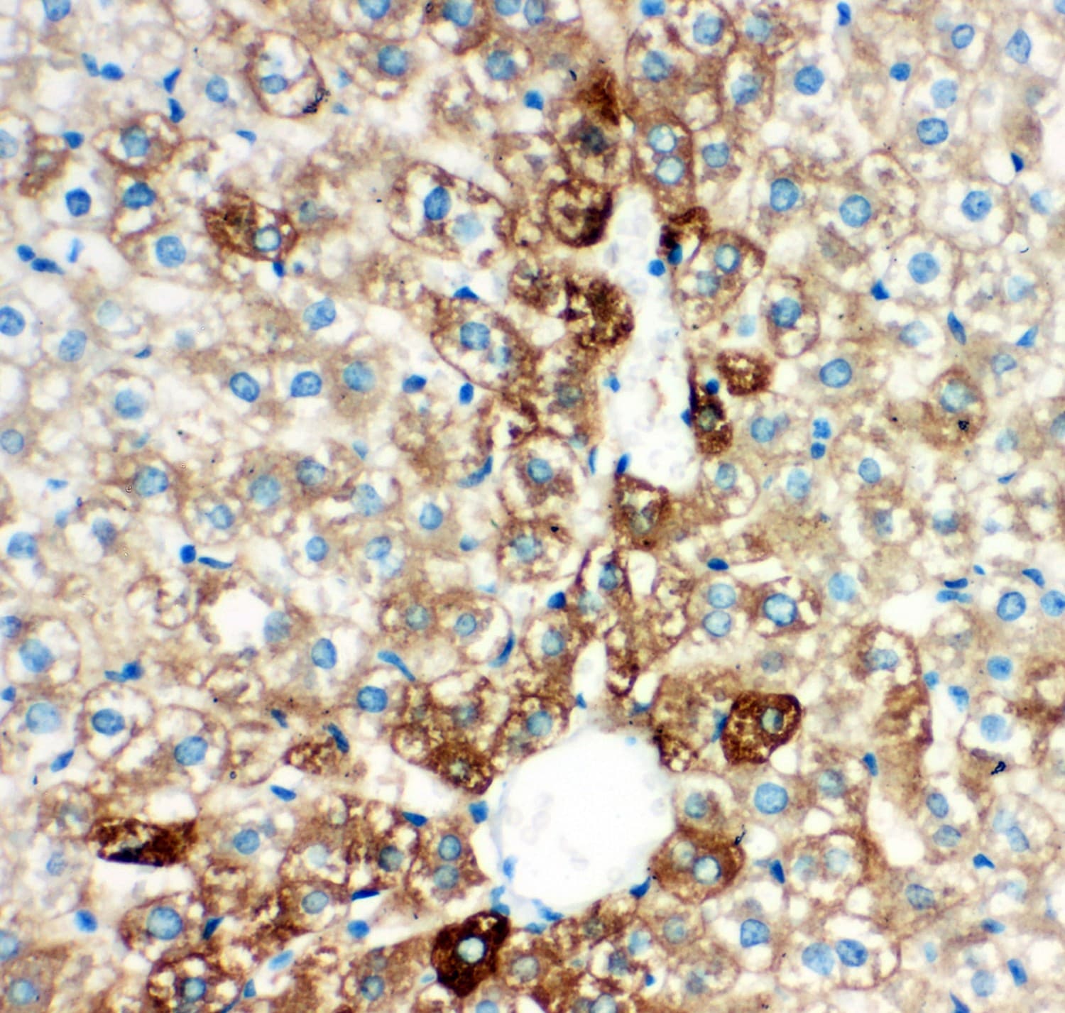 CYP2E1 Antibody (aa1-310)
