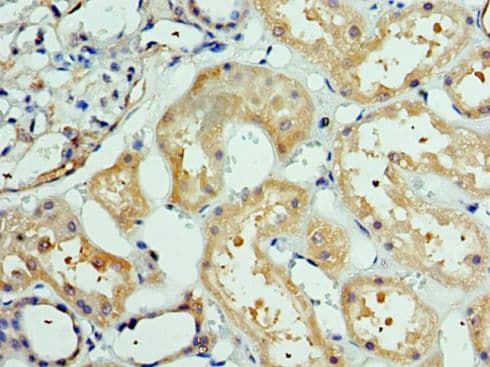 FLAME-3 / DEDD2 Antibody (aa1-240)