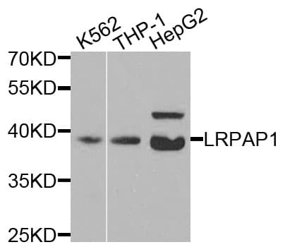 IHC-plus™ LRPAP1 Antibody