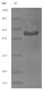 Human VAMP2 / VAMP-2 Protein (Recombinant GST, N-terminus)