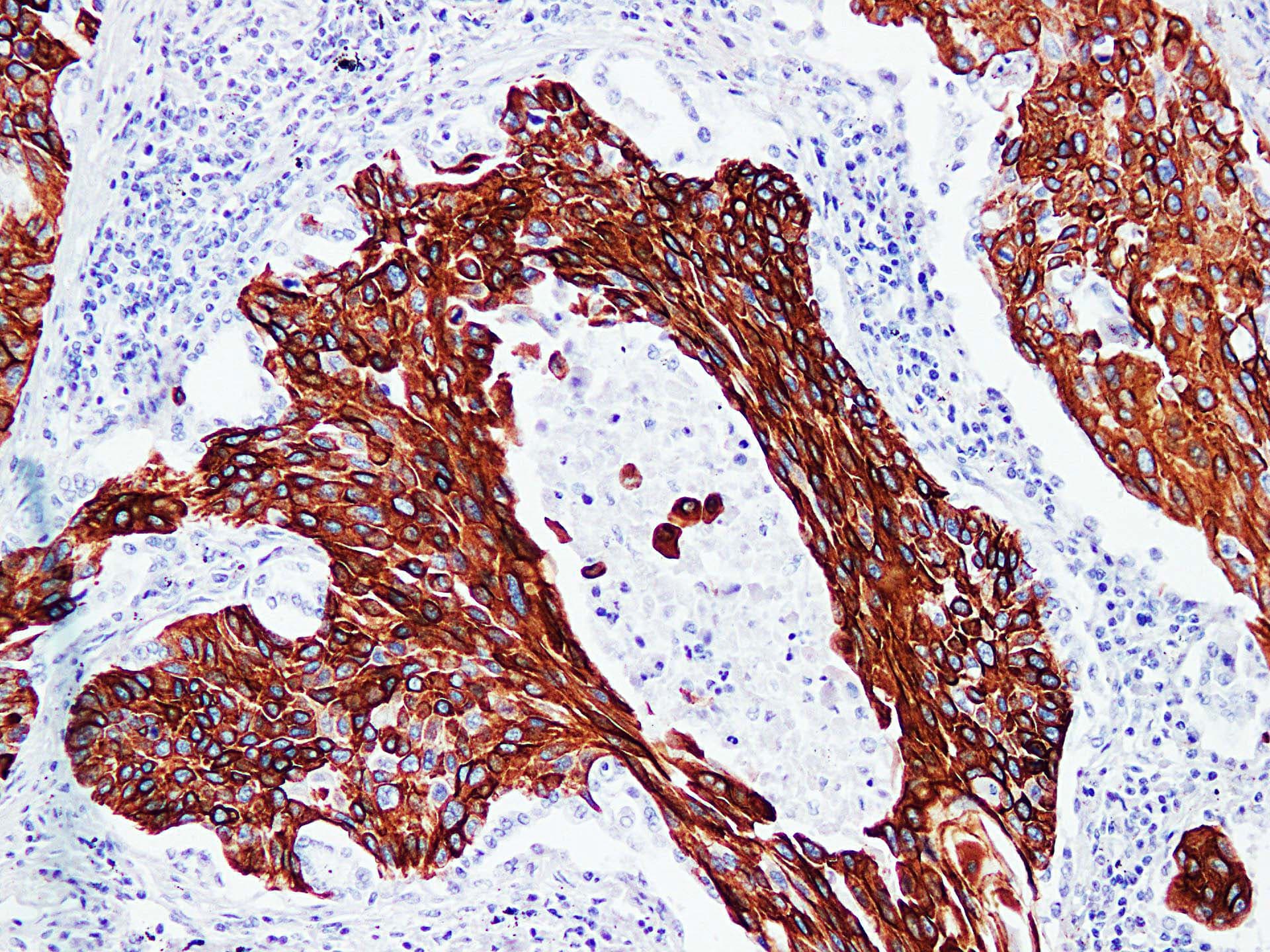 PathPlus™ KRT17 / CK17 / Cytokeratin 17 Antibody