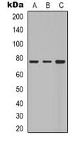 Polyclonal Rabbit anti-Human GLB1 / Beta-Galactosidase Antibody (Internal, IHC, WB)