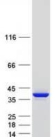 Human TPM1 / Tropomyosin Protein (Recombinant Myc-DDK (Flag))