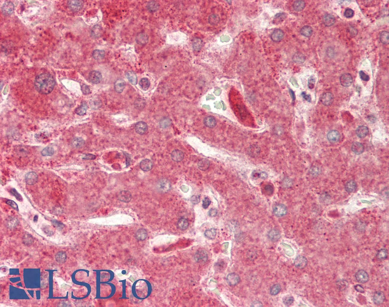 IHC-plus™ NINJ1 / Ninjurin Antibody