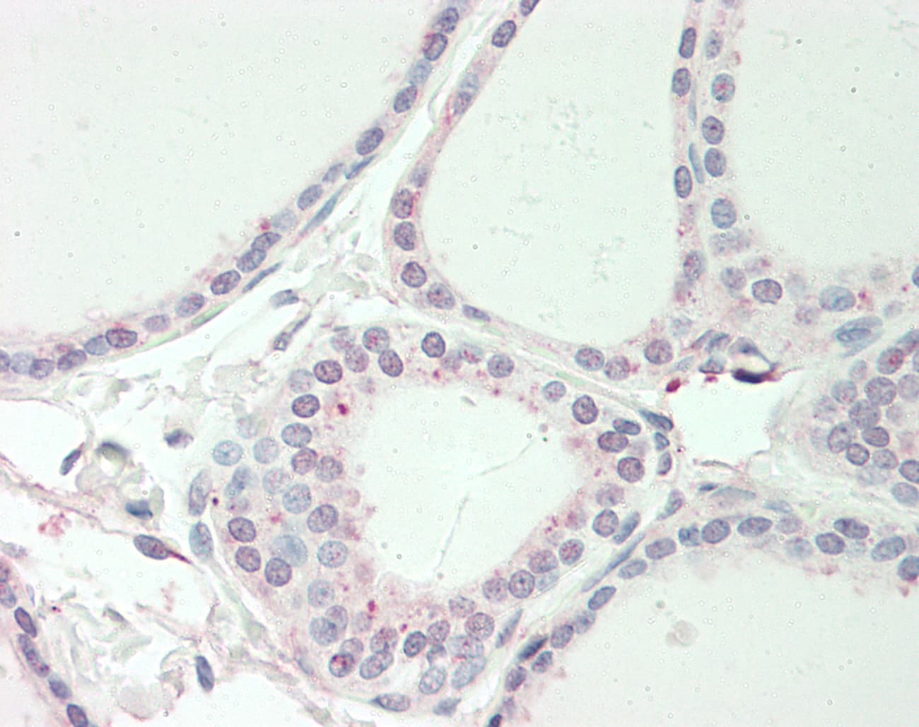 Polyclonal Rabbit anti-Human RNF13 Antibody (aa36-85, IHC, WB)