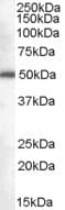 IHC-plus™ Polyclonal Goat anti-Human DDX6 Antibody (aa471-483, IHC, WB)
