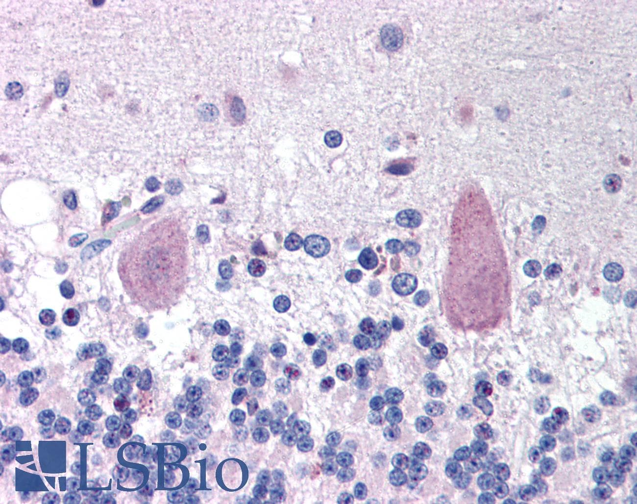 IHC-plus™ HTT / Huntingtin Antibody (phospho-Ser421)