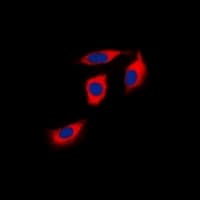 EPHA1 / EPH Receptor A1 Antibody (Internal)