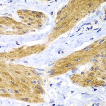 IHC-plus™ HRAS / H-Ras Antibody