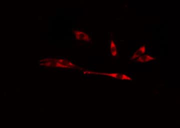 CHPF / CHSY2 Antibody