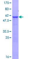 Human PNMT Protein (Recombinant GST)