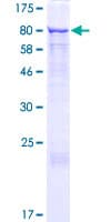 Human GRHL2 Protein (Recombinant GST)