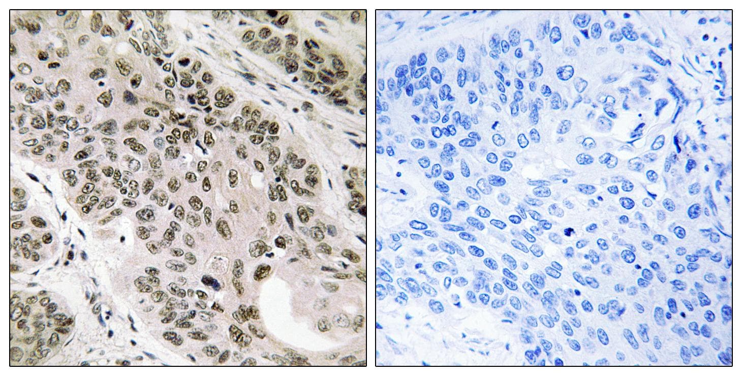 Polyclonal Rabbit anti-Human TNNI3K / CARK Antibody (IHC, WB)