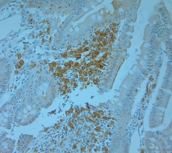 TANK Antibody (aa150-200)