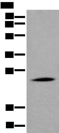APOD / Apolipoprotein D Antibody