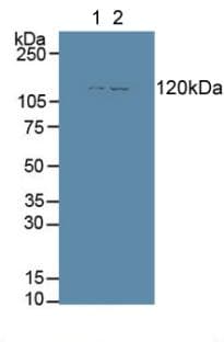 ENPEP / Aminopeptidase A Antibody (aa409-624)