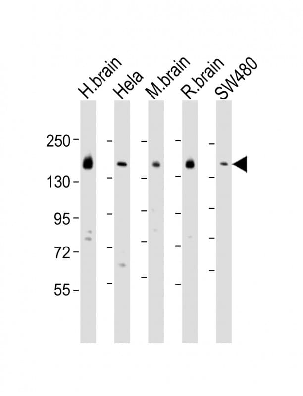 SYNJ1 / Synaptojanin Antibody (aa1148-1182)