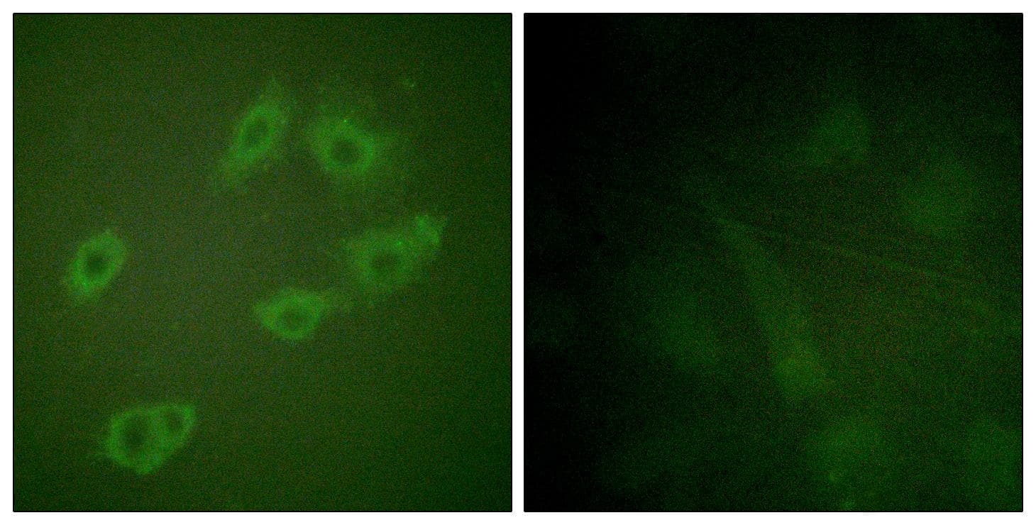 ERBB3 / HER3 Antibody (phospho-Tyr1222)