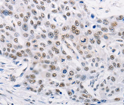 MURF1 / IRF Antibody