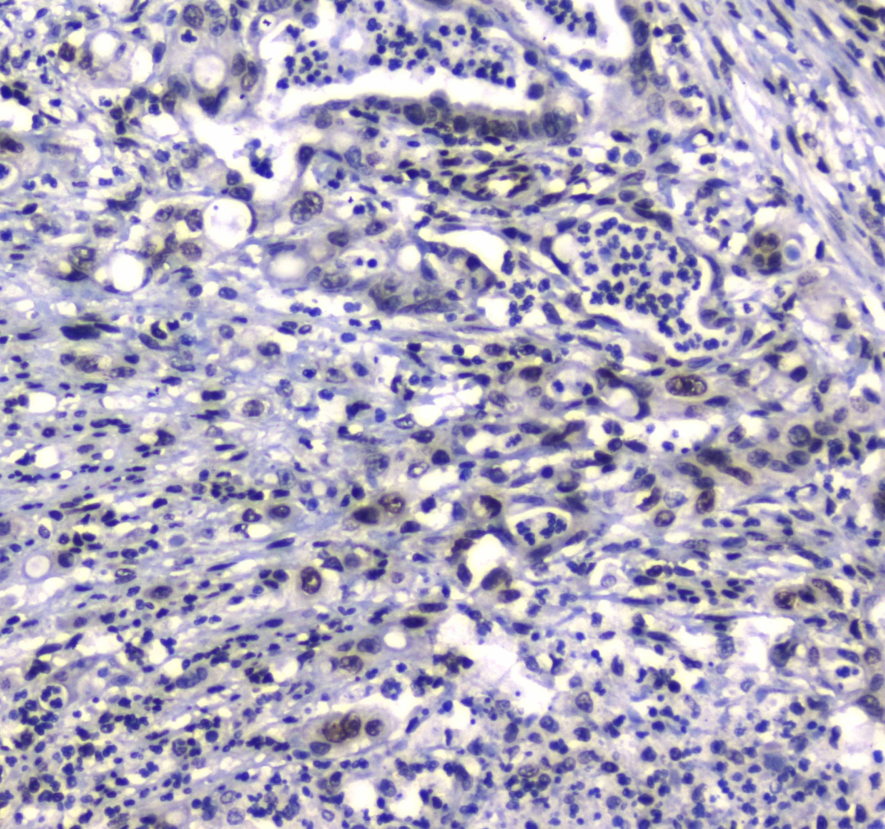 Polyclonal Rabbit anti-Human GFI1 Antibody (IHC)