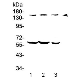 Polyclonal Rabbit anti-Human Kv10.1 / KCNH1 Antibody (WB)