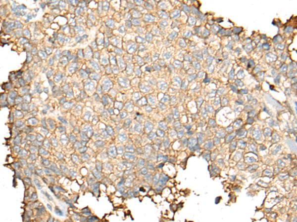 CD55 Antibody