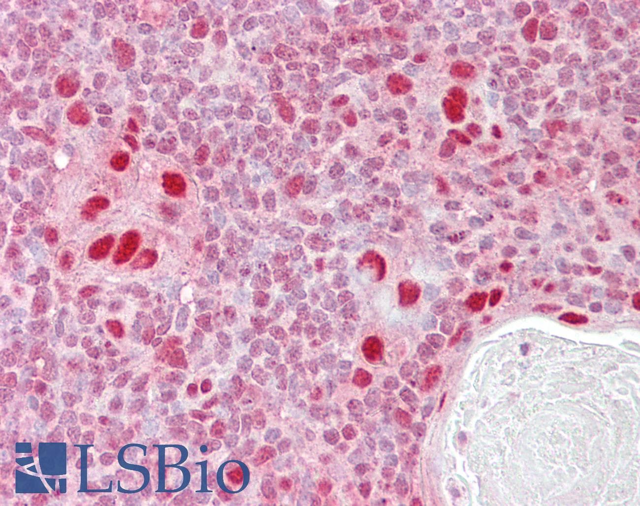 IHC-plus™ Polyclonal Goat anti-Human MSH5 Antibody (aa508-519, IHC)