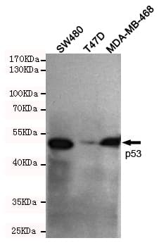 TP53 / p53 Antibody