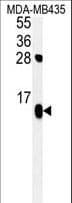Polyclonal Rabbit anti-Human ATP5D Antibody (aa1-30, IHC, WB)