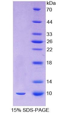 Human OCM / Oncomodulin Protein (Recombinant His-T7)