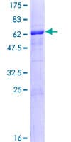 Human NHEJ1 / XLF Protein (Recombinant GST)