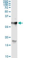 HYAL1 Antibody (clone 2H7)