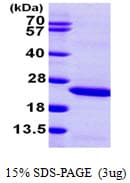 Human LCN2 / Lipocalin 2 / NGAL Protein (Recombinant His)