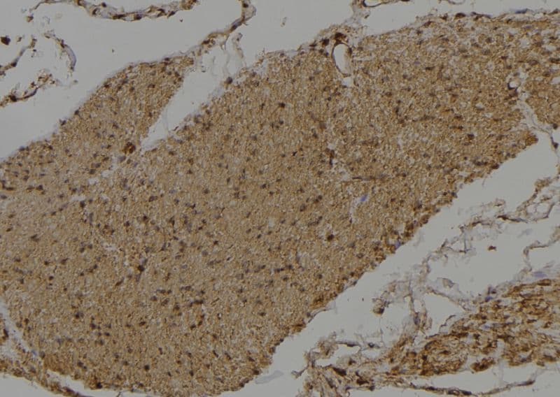 Polyclonal Rabbit anti-Human DVL3 / Dishevelled 3 Antibody (IHC, IF, WB)