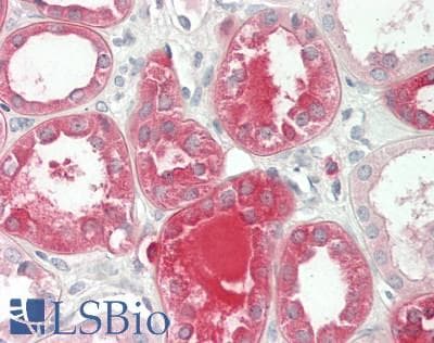 IHC-plus™ ADCY9 / Adenylate Cyclase 9 Antibody (aa984-1029)