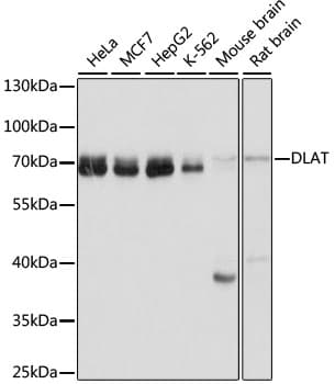 Polyclonal Rabbit anti-Human DLAT / PDC-E2 Antibody (WB)