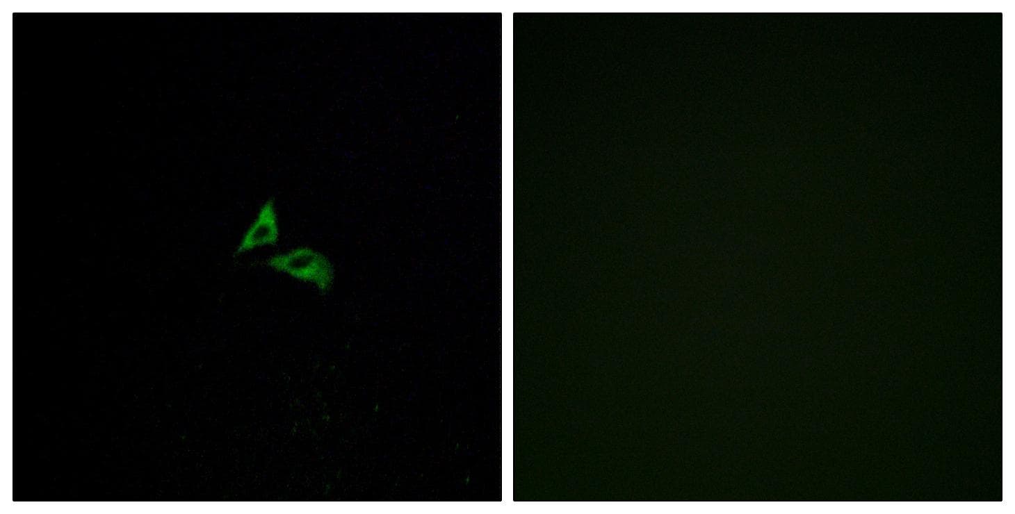 LPAR3 / LPA3 / EDG7 Antibody