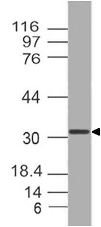 OTX2 Antibody