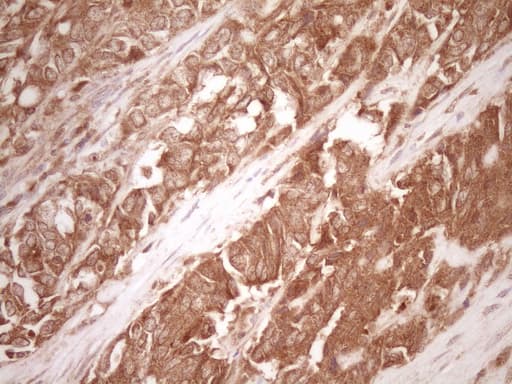 Monoclonal Mouse anti-Human MMP3 Antibody (clone OTI1E9, aa246-477, IHC, WB)