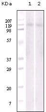 EPHB6 / EPH Receptor B6 Antibody (clone 8E7H12)
