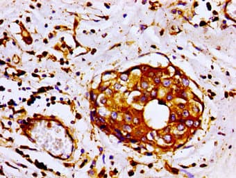 FLNA / Filamin A Antibody