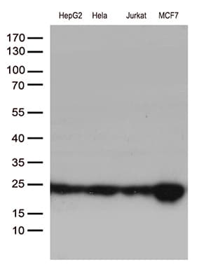 Monoclonal Mouse anti-Human MGMT Antibody (clone OTI2F10, IHC, WB)