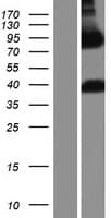 ARHGAP22 / RhoGAP2 Protein (Over-Expression Lysate Myc-DDK (Flag))