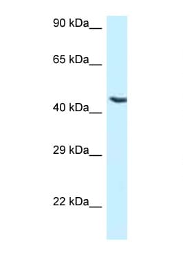 NR5A1 / SF1 Antibody (aa231-280)
