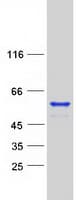 Human MEIS2 Protein (Recombinant Myc-DDK (Flag))