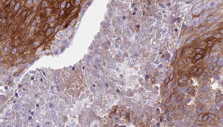 S100A8 / MRP8 Antibody