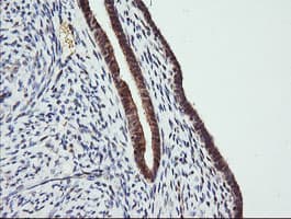 TRMT2A Antibody (clone OTI2C6)
